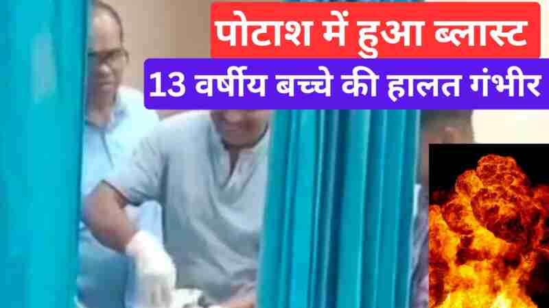 13 year old boy from Churu injured after potash caught fire